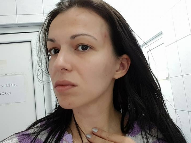 Mis Tigrova Ceco Bokluka Me Prebi Tichah Po Gashi Do Ssed Snimka Trafficnews Bg Trafficnews Bg